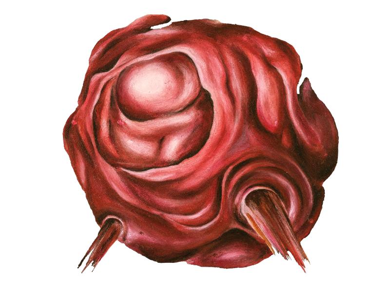 Rapatronic